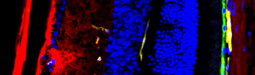 Stem Cell