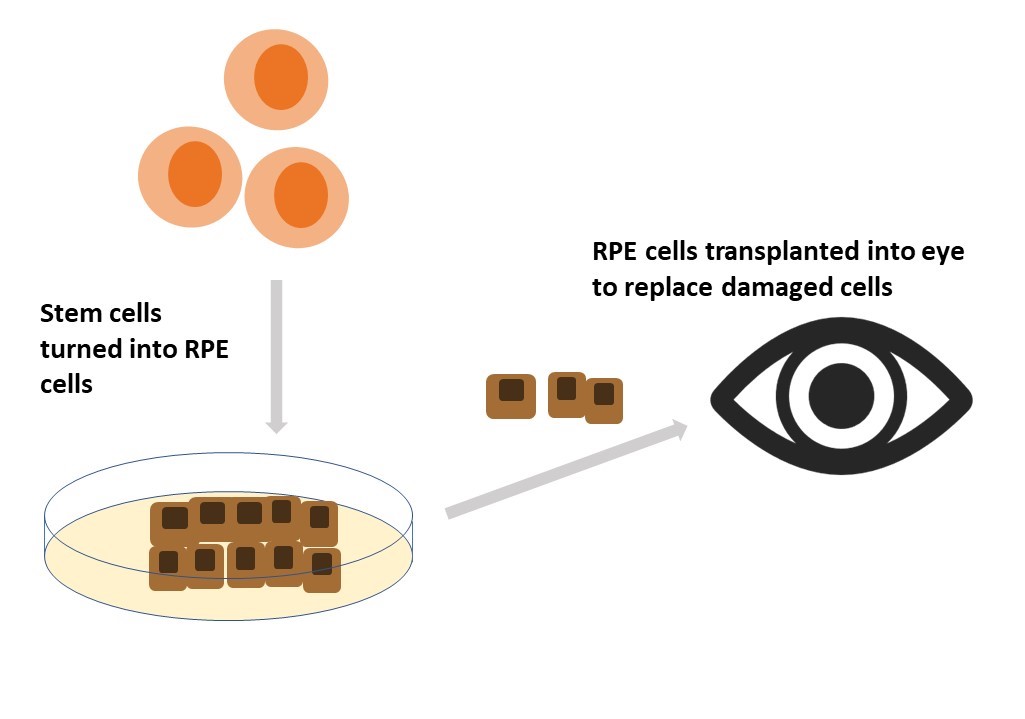 stem cell technology to cure eye diseases research paper