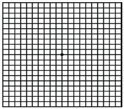 Image is of the amsler grid