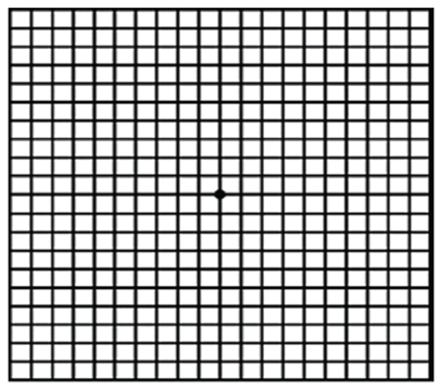 Image is a sample of the Amsler test for monitoring vision