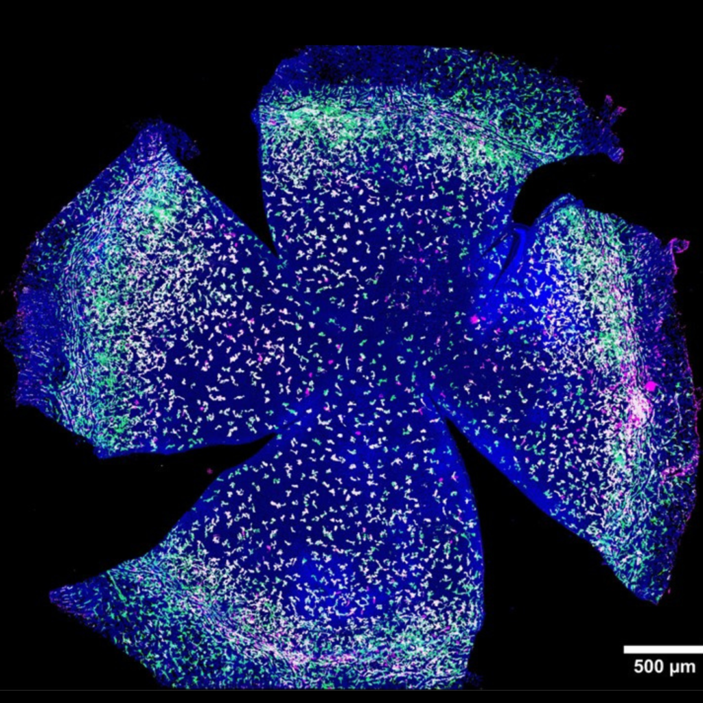 Image is a microscope capture of macrophages (immune cells) in the cornea of a mouse eye.