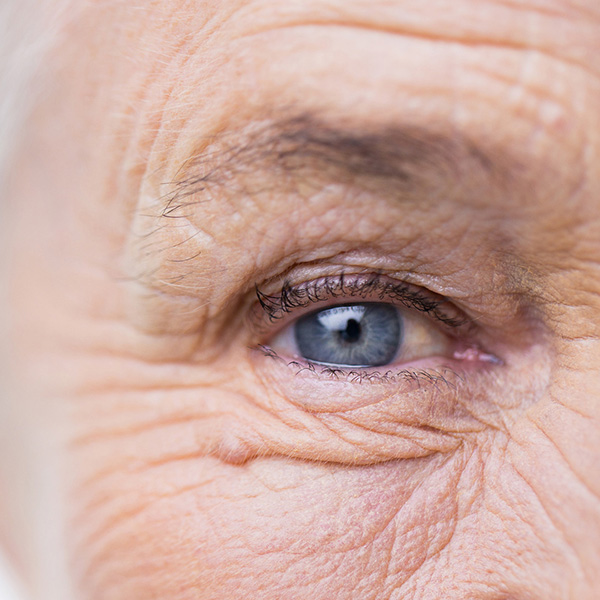 old person's eye