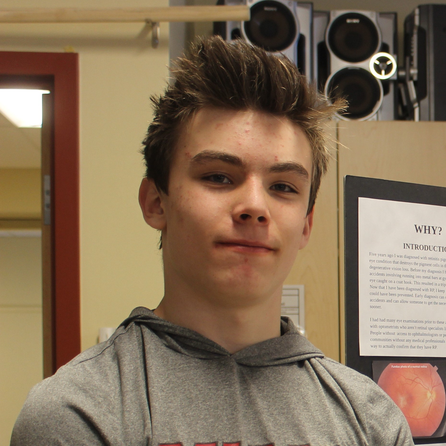 Harry Nickerson Harnessing the Power of AI for Early Diagnosis of