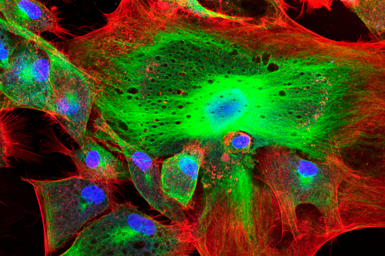 confocol microscope imaging