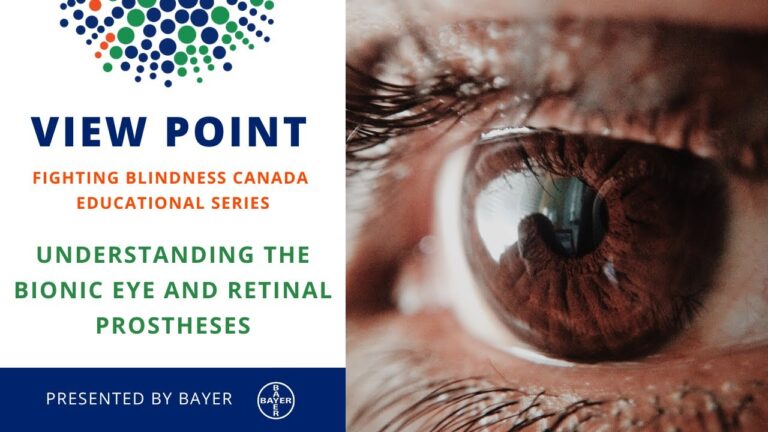 View Point Fighting Blindness Canada Educational Series Understanding the Bionic Eye and Retinal Prostheses